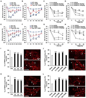 TMEM100, a regulator of TRPV1-TRPA1 interaction, contributes to temporomandibular disorder pain